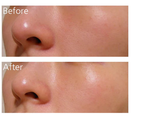 Klairs Rich Moist Soothing Serum 80ml